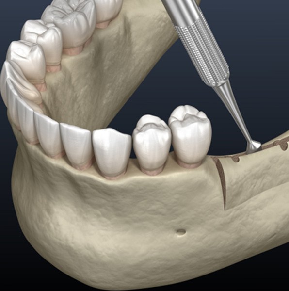advanced 4 - Distinctive Dentistry