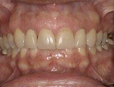 case 10b - Distinctive Dentistry