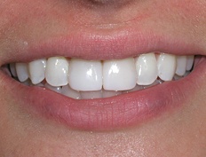 case 11a - Distinctive Dentistry