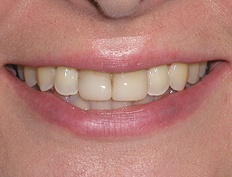 case 11b - Distinctive Dentistry