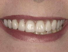 case 12a - Distinctive Dentistry