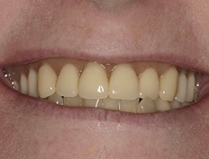 case 12b - Distinctive Dentistry