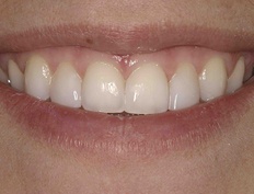 case 13a - Distinctive Dentistry