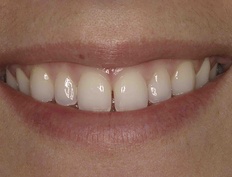 case 13b - Distinctive Dentistry