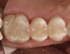 case 14a - Distinctive Dentistry