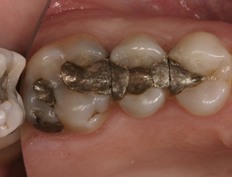 case 14b - Distinctive Dentistry