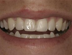 case 15a - Distinctive Dentistry