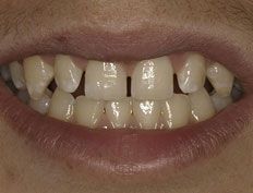 case 15b - Distinctive Dentistry
