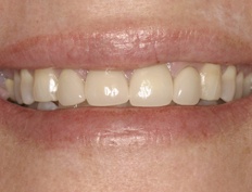 case 1b - Distinctive Dentistry