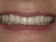 case 2a - Distinctive Dentistry