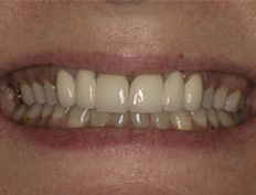 case 2b - Distinctive Dentistry