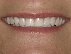 case 3a - Distinctive Dentistry
