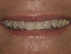 case 3b - Distinctive Dentistry