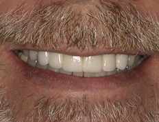case 4a - Distinctive Dentistry