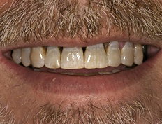 case 4b - Distinctive Dentistry