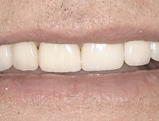 case 5a - Distinctive Dentistry