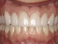 case 6a - Distinctive Dentistry