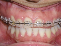 case 6b - Distinctive Dentistry