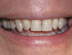 case 7b - Distinctive Dentistry