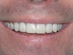 case 8a - Distinctive Dentistry