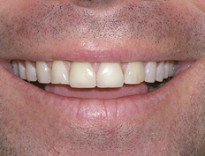 case 8b - Distinctive Dentistry
