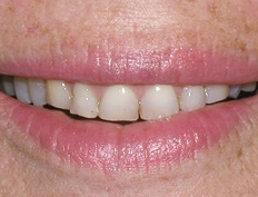 case 9b - Distinctive Dentistry