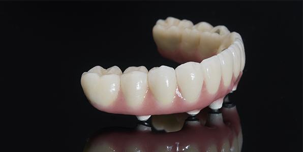 implants 7 - Distinctive Dentistry