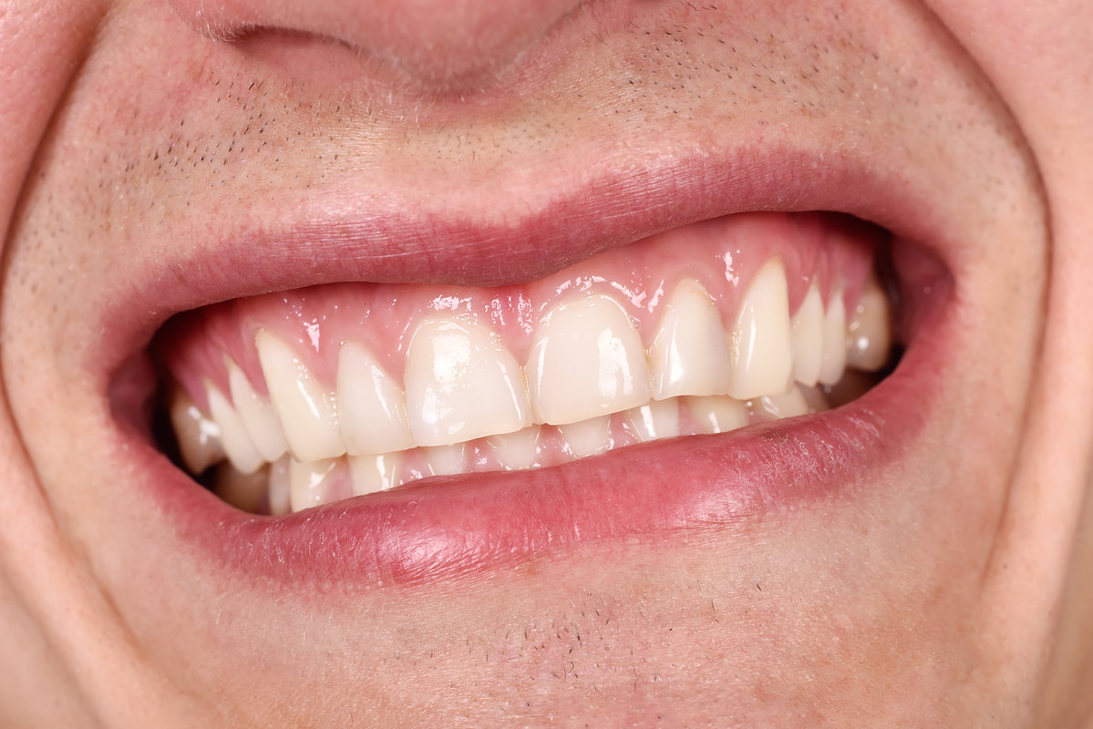 male mouth laughing and showing his teeth, close up