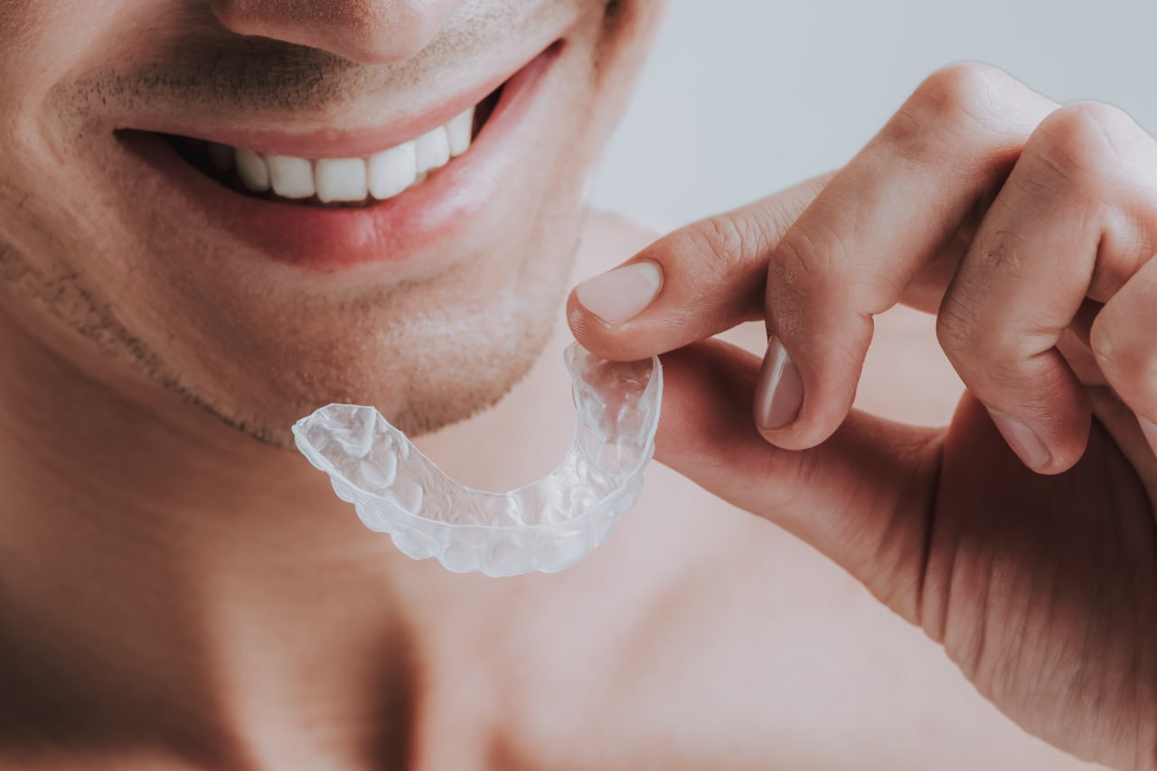 Woman Putting Transparent Aligner In Teeth Stock Photo