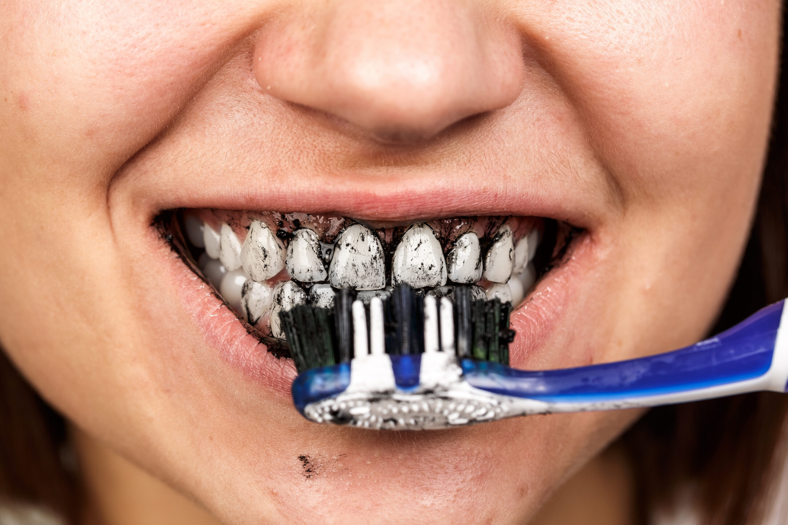 Young woman holding a toothbrush with black activated charcoal toothpaste close-up