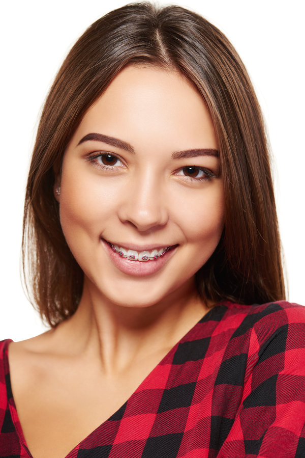 Closeup portrait of young teen female smiling with braces on her teeth